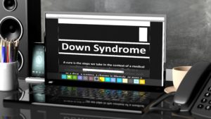 7-1-16 Down Syndrome & Ultrasound Markers-min
